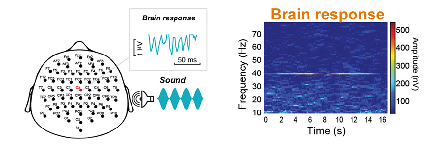 Neural Signatures of Auditory Hypersensitivity